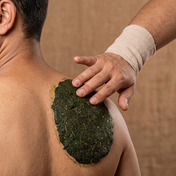 LEPANAM (sapuan pes herba berubat pada bahagian badan yang terjejas)